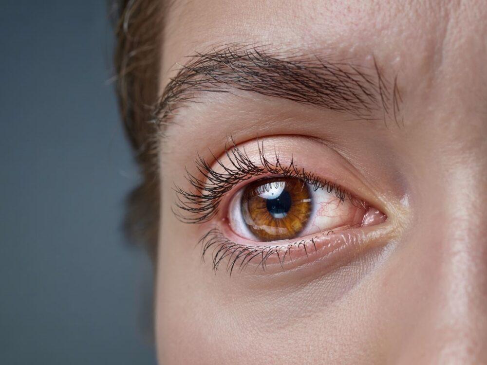 krzywo rosnące rzęsy